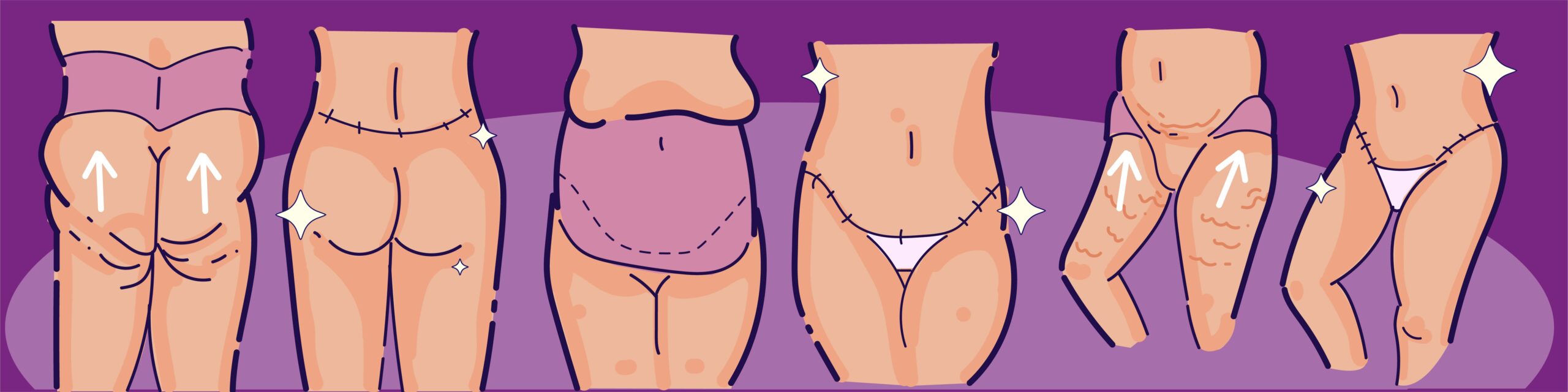 FAQs about Tummy Tuck and Lower Body Lift