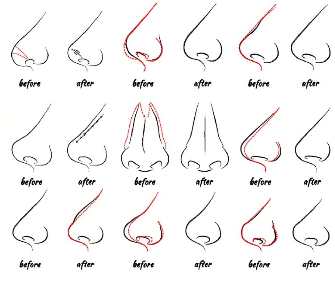 Types Of Noses Chart