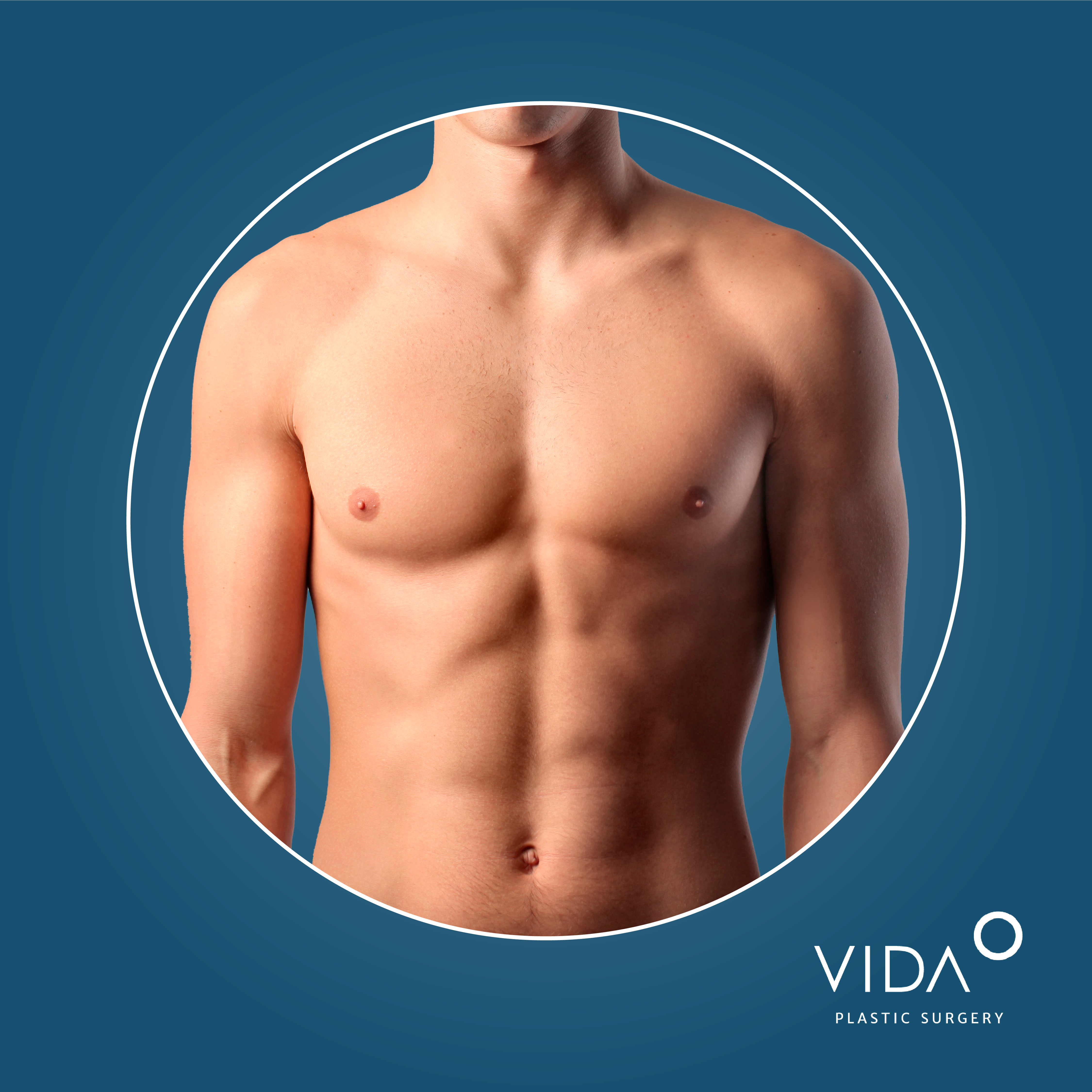 What men need to know about gynecomastia surgery - VIDA Wellness and Beauty